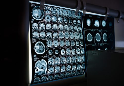 x-ray, mri, ct scan